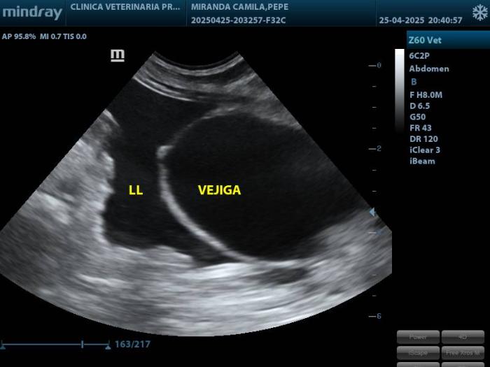 Figura 1. (A) El ultrasonido abdominal se realizó con un ecógrafo marca Mindray Z60 , se utilizó un transductor microconvexo multifrecuencia para hacer un A-FAST (Focused Abdominal Sonography for Trauma) , resultando positivo en 2 de los 4 cuadrantes. (B) Se tomaron las medidas pertinentes del riñón izquierdo.