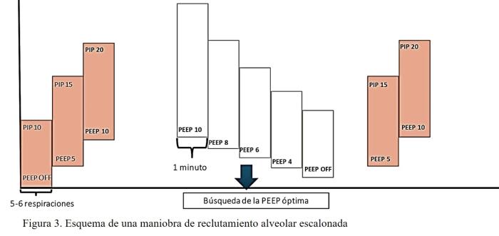 Figura 3. Esquema de una maniobra de reclutamiento alveolar escalonada.