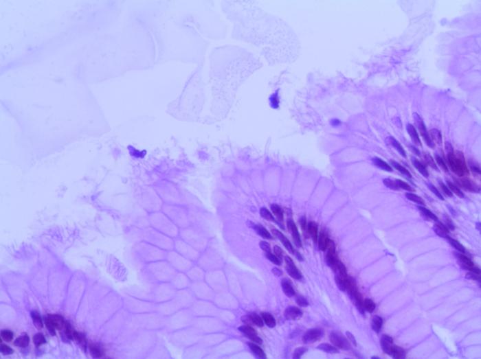 Figura 2. Visualización directa de Helicobacter spp. en la superficie del epitelio de revestimiento luminal del estómago. Imagen cedida por Histolab.