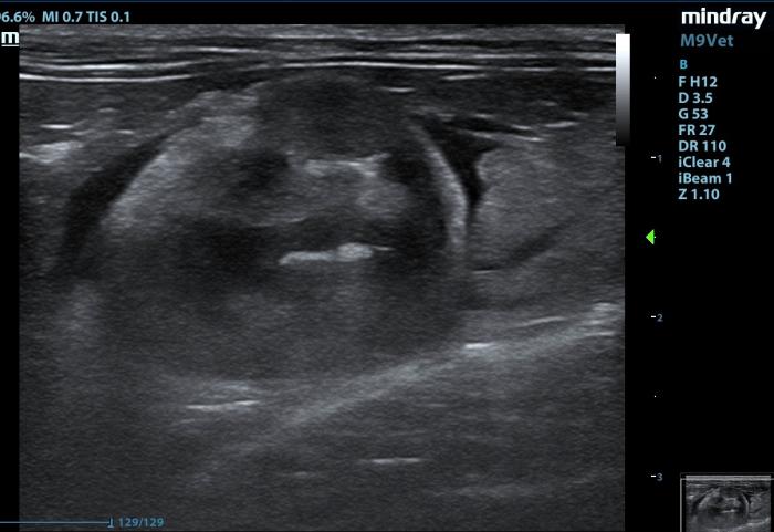 Figura 6. (A) Pielonefritis en un gato con ERC. Obsérvese el menor tamaño renal, los infartos múltiples y los signos de pielonefritis como liquido libre peirenal y dilatacion de la pelvis. (B) Contenido purulento en pelvis renal diltada en un gato con pielonefritis.