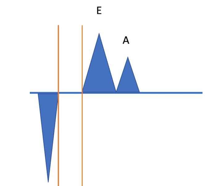 Figura 3. (A) La medición del tiempo de relajación isovolumétrica, desde que acaba el flujo aórtico, hasta que empieza en la línea base la onda E del flujo mitral. (B) Ejemplo de medición del TRIV en un Chihuahua de 3 años.