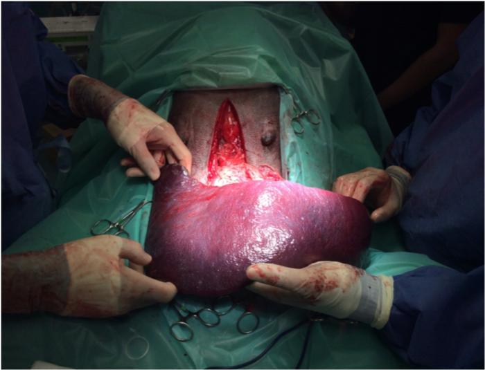 Figura 5. Esplenomegalia por síndrome de dilatación-vólvulo gástrico en el perro.