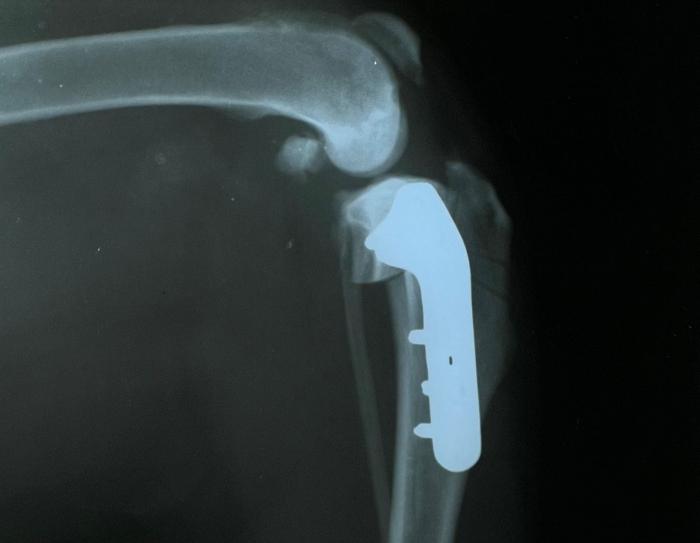 Figura 1. Radiografía posquirúrgica inmediata de TPLO.