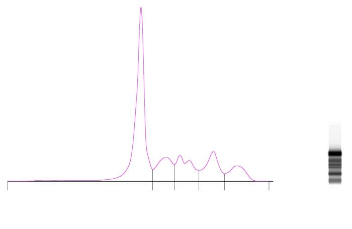 Figura 1. Electroforetograma de una cobaya (Cavia porcellus) obtenido mediante electroforesis de zona capilar en plasma EDTA.