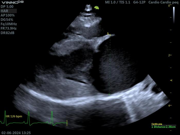 Figura 8. Ecocardiografía 2D en un gato con HCM. Proyección paraesternal derecha de eje largo 4 cámaras. Valoración del diámetro septolateral de la AI (LAmax= 23.6 mm).