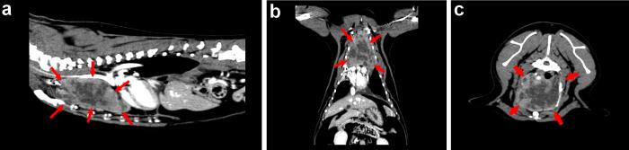 Figura 1. Estudio mediante TC de la masa mediastínica. Cortes (A) sagital, (B) dorsal y (C) transversal.