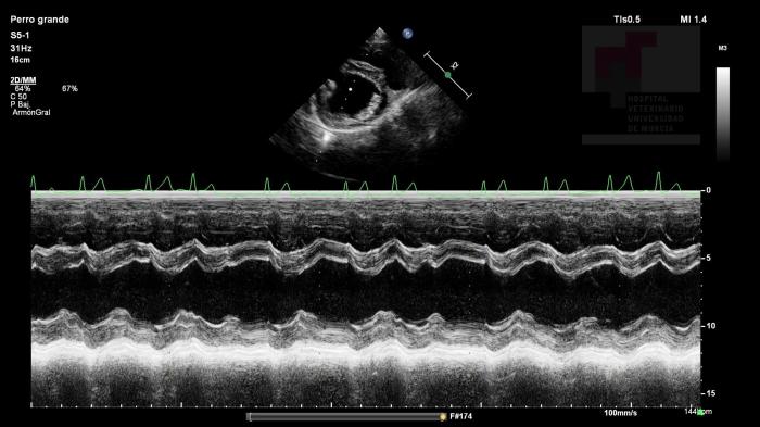 Figura 4. Corte paraesternal derecho en eje corto en modo M, función sistólica adecuada: fracción de acortamiento de 36.2 %. Se observa fibrilación atrial en el electrocardiograma.