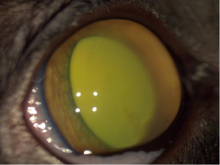 Figura 3. (A) Detalle Efecto Tyndall. (B) Detalle sinequia posterior e hipopion en un gato con uveítis idiopática unilateral. (C) Detalle presencia de fibrina en cámara anterior. (D) Detalle mutton fat en un gato con PIF (confirmado en necropsia). (E) Glaucoma secundario a uveítis por leucemia. Obsérvese la característica pupila en forma D de invertida en un OD. (F, G) Uveítis secundaria a linfoma.