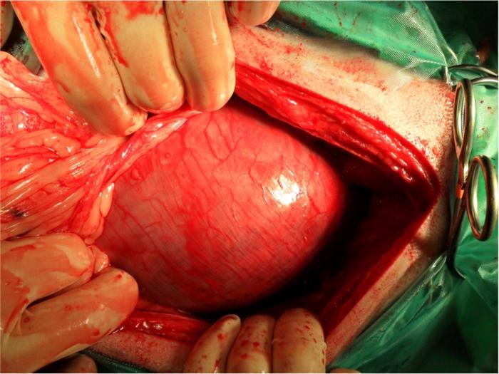 Figura 1. Imagen intraquirúrgica de estómago dilatado y torsionado al acceder a la cavidad abdominal mediante laparotomía por línea media. Se ha retirado el omento momentáneamente para ver el compromiso de la pared gástica, donde se observa congestión.