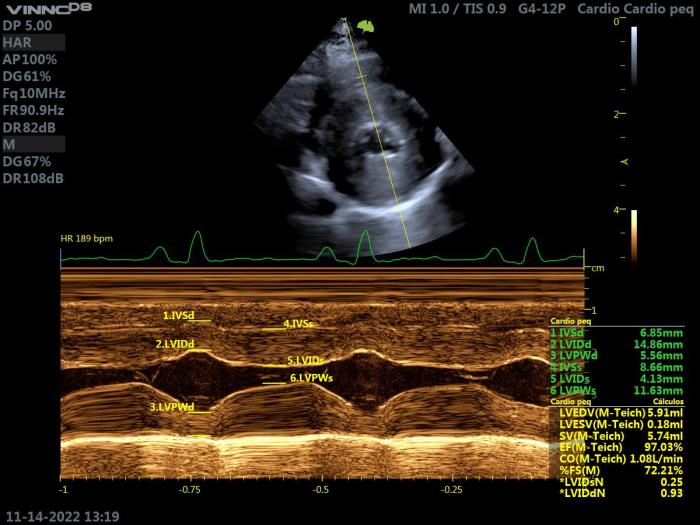 Figura 9. Ecocardiografía modo M en un gato con HCM. Proyección paraesternal derecha de eje corto a nivel del VI. Se identifica un claro aumento de grosor del septo, con una cámara ventricular de volumen normal y FS normal.