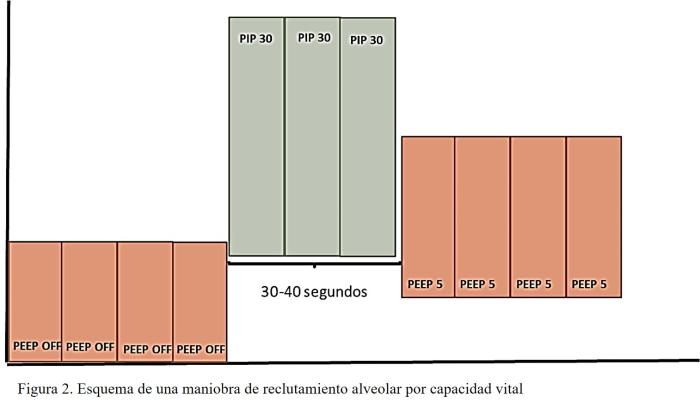 Figura 2. Esquema de una maniobra de reclutamiento alveolar por capacidad vital.