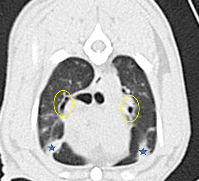 Figura 7. Imagen de tomografía computarizada en algoritmo pulmón, plano transversal. Adquisición de imágenes poscontraste. Se trata de un gato seropositivo a Dirofilaria immitis. La izquierda del paciente está a la derecha de la imagen. Se aprecia dilatación de la luz bronquial (círculo amarillo) y patrón intersticial (estrella azul).