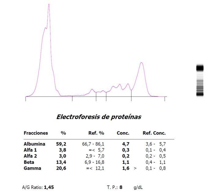 Figura 2. Hipergammaglobulinemia en una coneja (Oryctolagus cuniculus) con parotiditis