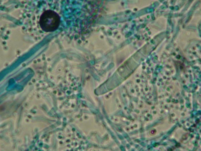 Figura 1. Imagen de los macroconidios de T. mentagrophytes con aspecto de cigarro/puro, con segmentaciones (entre 2-7) con tinción de azul de metileno tras cultivo fúngico e incubación durante 12 días.