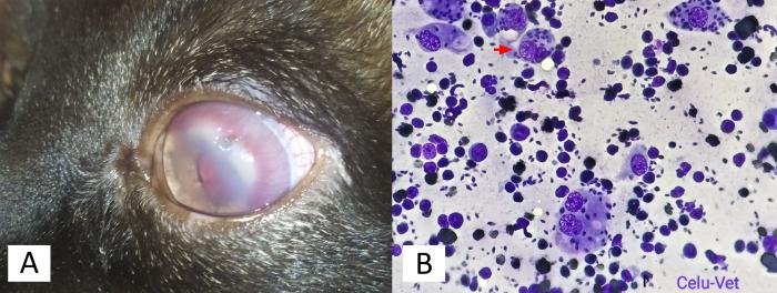 Figura 2. (A) Inflamación y opacidad corneal en el paciente. (B) Imagen citológica de inflamación interdigital de miembro anterior izquierdo con presencia de amastigotes de Leishmania spp en macrófago (flecha roja).