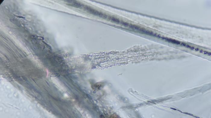 Figura 4. Imagen de tricografía, donde se observan varios pelos con estructuras circulares acinares invadiendo la médula y con rotura de la corteza del pelo, además de la pérdida de los raíles de tren de la melanina y aspecto tortuoso de estos.