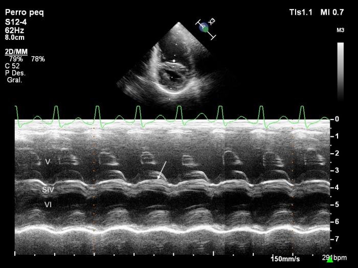 Figura 3. Ecocardiograma modo M, obtenido mediante acceso paraesternal derecho de eje corto, nivel ventricular, donde se observa dilatación del ventrículo derecho (VD), movimiento sistólico anterior del septo ventricular (SIV) (flecha) y reducido tamaño del ventrículo izquierdo (VI).