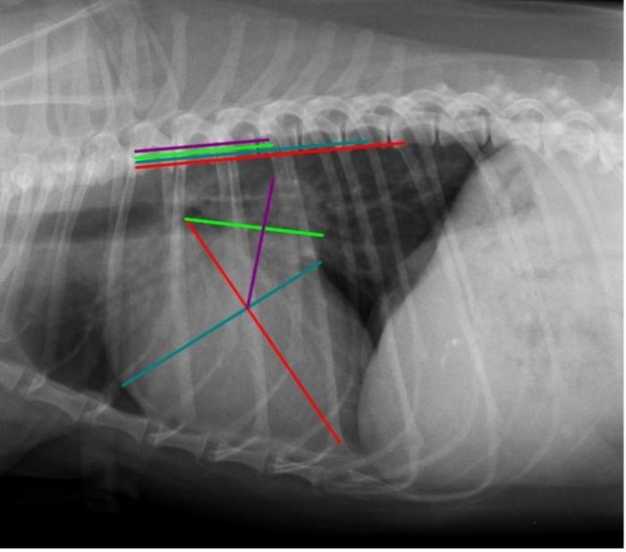 Figura 2. Proyección radiográfica lateral derecha de tórax de Kira (estadio B2 de EDVM). Las líneas roja y azul representan los ejes largo y corto del VHS, obtenido como en la publicación original (Buchanan y Bücheler 1995). La línea verde representa la VLAS, trazándose una línea desde el aspecto ventral de la carina hasta el borde más caudal del AI en el punto de intersección con el borde dorsal de la vena cava caudal (VCC). La línea morada es la RLAD, trazándose la bisectriz desde la intersección entre el eje largo y el eje corto del VHS hasta el borde dorsal del atrio izquierdo. Posteriormente, estas medidas se transponen, de forma paralela a la columna, al inicio del cuerpo vertebral de la cuarta vertebra torácica (T4), y se cuantifica el número de cuerpos vertebrales que ocupa la suma de los ejes del VHS y el número de cuerpos vertebrales que ocupa la RLAD y la VLAS. Se obtuvieron los siguientes valores: VHS 11.7v, VLAS 3.3v y RLAD 3.2v, indicando cardiomegalia y dilatación marcada del AI.