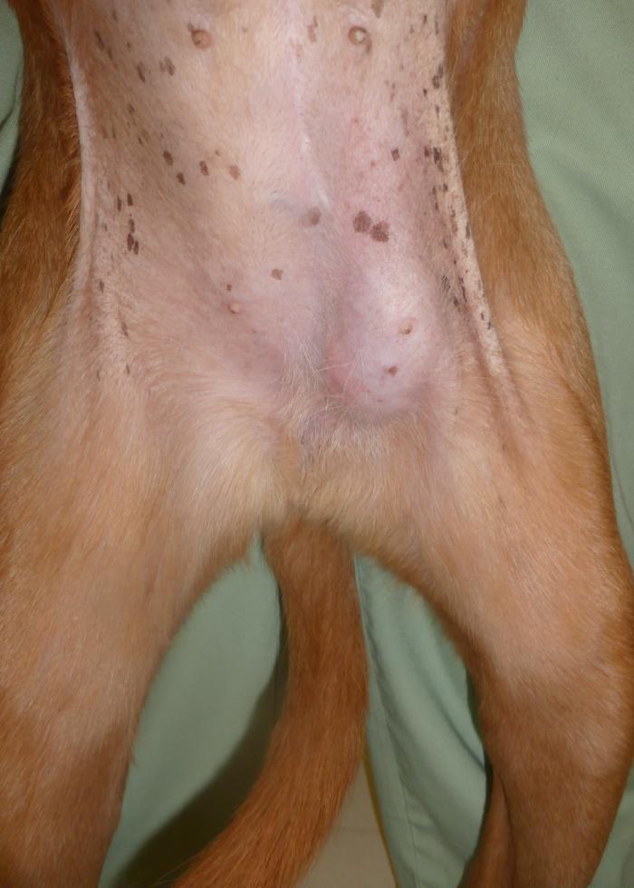 Figura 1. Nódulo localizado en zona inguinal. Paniculitis nodular estéril.