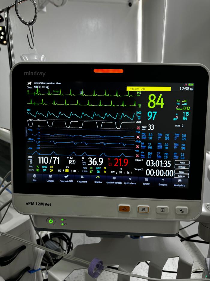 Figura 5. Imagen del monitor durante el período intraoperatorio de lobectomía pulmonar de Zeus, donde observamos la estabilidad del paciente con los bloqueos analgésicos ESP y BPS.