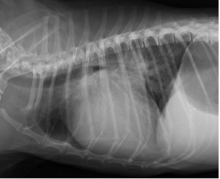 Figura 6. Proyección radiográfica lateral derecha de tórax del mismo caso que la Figura 4, obtenida dos meses después, donde se observa el empeoramiento del patrón intersticial perihiliar.