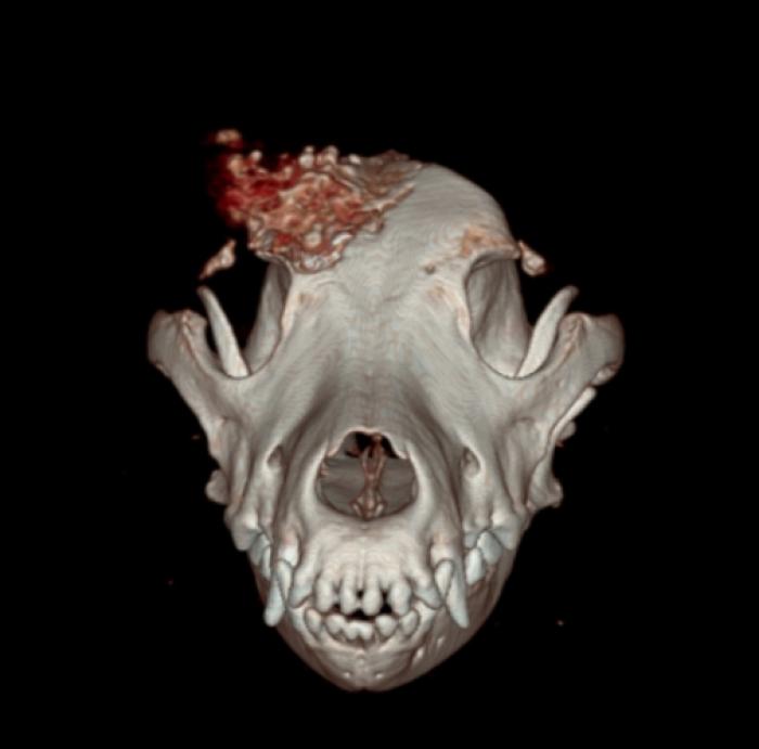 Figura 1.Tomografía axial prequirúrgica (reconstrucción 3D).