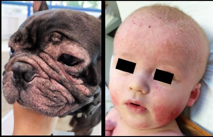 Figura 1. Comparación del fenotipo de dermatitis atópica hombre-perro. Lesiones faciales. Fotos: Servicio de dermatología del ENVT y Dra. Pauline Bernard.