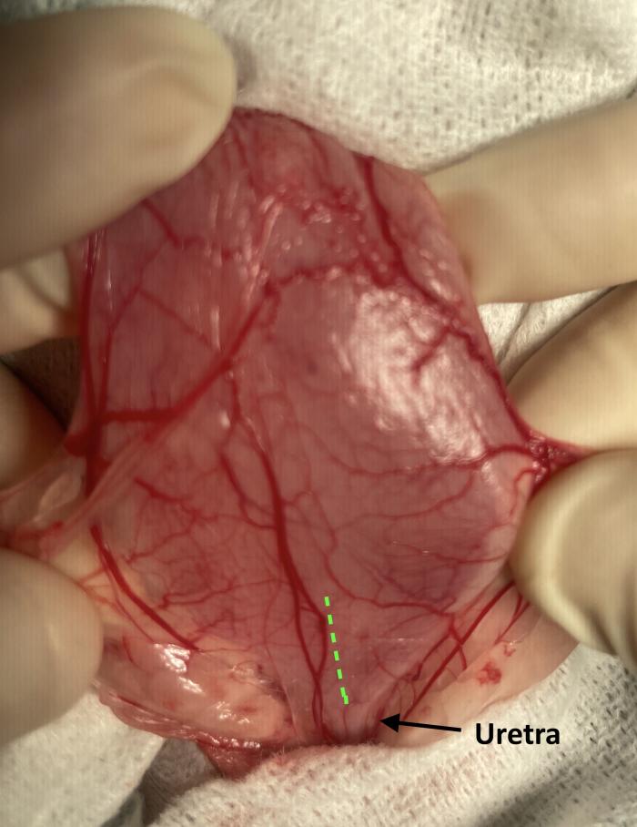 Figura 7. Disposición retrógrada de catéter JJ en macho especie felina, acceso asistido por cirugía. (A) Pared ventral de la vejiga de la orina mediante laparotomía media distal. La línea de puntos indica el lugar de cistotomía para exposición de los orificios ureterales. (B) Cateterización de orificio ureteral derecho con guía hidrofílica de 0.018”, para continuar con el procedimiento bajo control fluoroscópico.