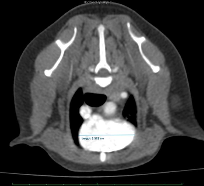 Figura 2. (A) Imagen axial del estudio TAC, con la medición de la anchura de 3.3 cm. (B) Imagen de reconstrucción multiplanar con la proyección sagital. (VCcr: Vena Cava Craneal; AD: Aurícula derecha).