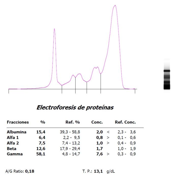 Figura 5. Marcada hipergammaglobulinemia e hipoalbuminemia en un hurón con coronavirus sistémico (FSCV) en (A) la presentación inicial y (B) evolución a finales de un ciclo de tratamiento antiviral.