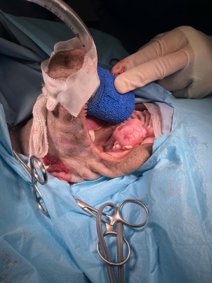 Figura 4. Paciente posicionado para la resección de la masa. Se puede observar la colocación del esparadrapo alrededor del tubo endotraqueal para evitar su desconexión durante la manipulación de la boca, y un rollo de venda elástica como abrebocas.