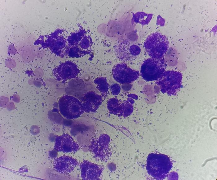 Figura 2. Imagen citológica de mastocitoma cutáneo canino.