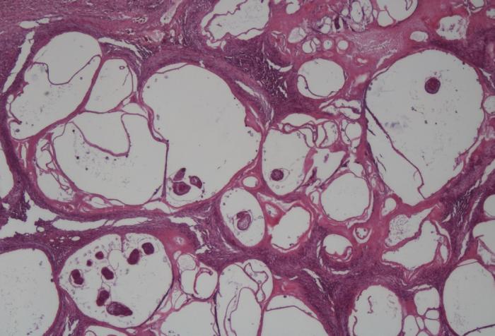 Figura 3. Histología de una lesión quística del hígado, con secciones transversales de protoscólices, tinción HE, 40 aumentos (fuente: LABOKLIN).