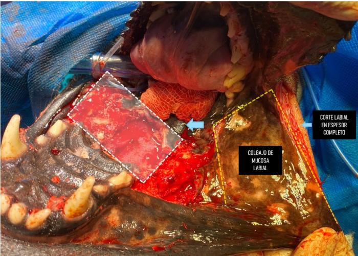Figura 6. Vista intraoral de la confección del colgajo labial en espesor parcial. Se procede con el corte caudal (línea blanca) para luego divulsionarlo separando la mucosa de la piel labial.
