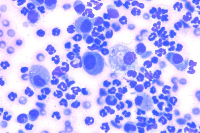 Figura 15. Citología de tipo piogranulomatoso, sin presencia de agentes microbianos.