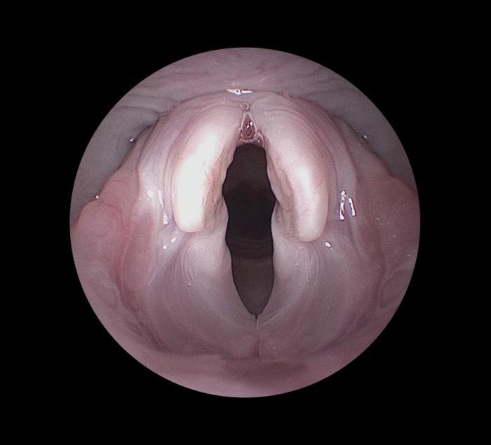 Figura 1. Imagen endoscópica de la laringe felina sana.  