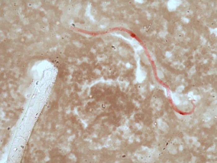 Figura 5. Microfilaria de Dirofilaria immitis teñida por el método de las fosfatasas ácidas donde se aprecia actividad enzimática en los poros anal y excretor.