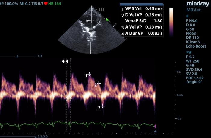 Figura 10. Flujo vena pulmonar normal en un gato de 12 años.