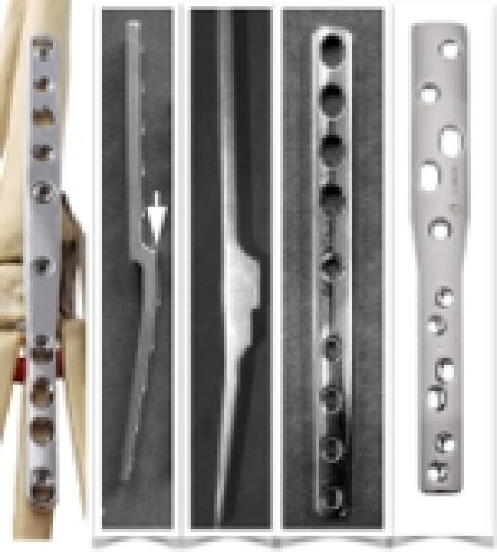 Figura 7. De izquierda a derecha: placa híbrida bloqueada,  placa híbrida escalonada (2), placa osteosíntesis híbrida y placa híbrida Castless.