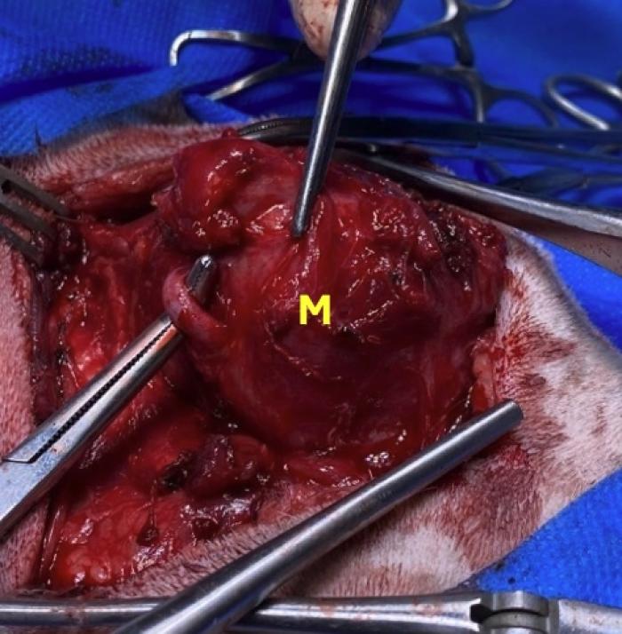 Figura 5. Imágenes intraquirúrgicas. (A, B) Retracción de músculos esternohioideos y esternotiroihoideos y masa (M). (C) Imagen luego de la extracción de la masa.