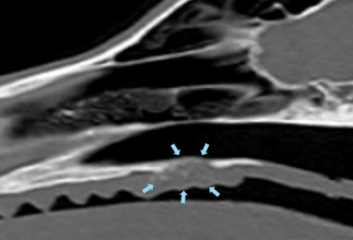 Figura 2. (A) Imagen tomográfica donde se señala con flechas el patrón óseo alterado por el tumor. (B) Corte transversal. (C) Corte coronal.