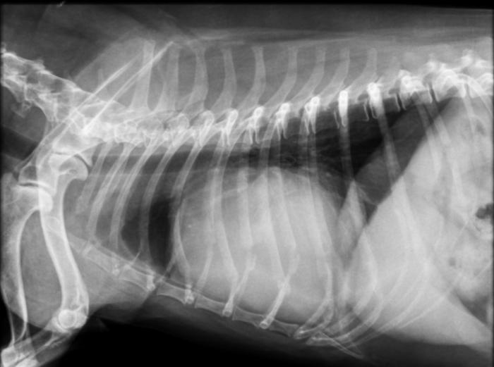 Figura 2. Radiografía laterolateral derecha de un paciente con taponamiento cardíaco, en la que se observa la silueta cardíaca de aspecto globoso (imagen cedida por el Servicio de Diagnóstico por Imagen del HCVC).