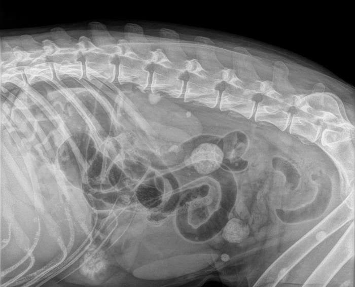 Figura 5. OEE Metástasis en abdomen.