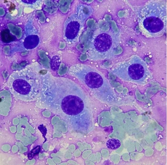 Im&aacute;genes de citolog&iacute;a: Dr M.V. Edie Avila Kristancic (MSc en oncolog&iacute;a cl&iacute;nica,&nbsp; diplomado en citopatolog&iacute;a veterinaria).