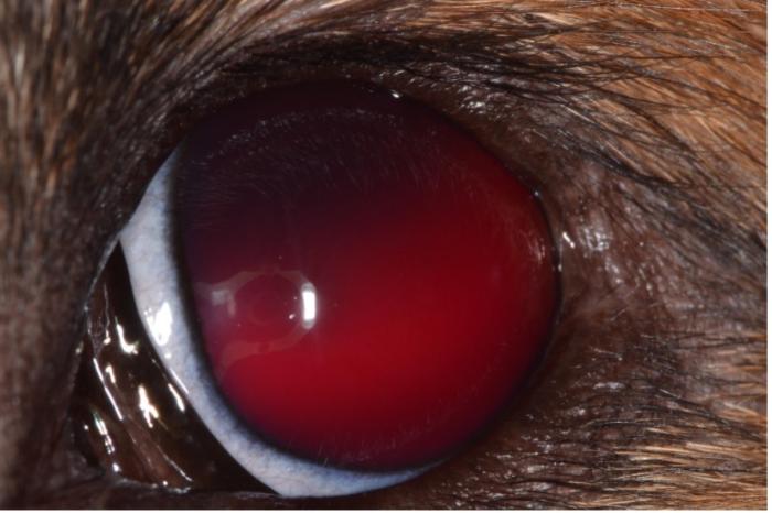 Figura 1. Ojo izquierdo con hifema.