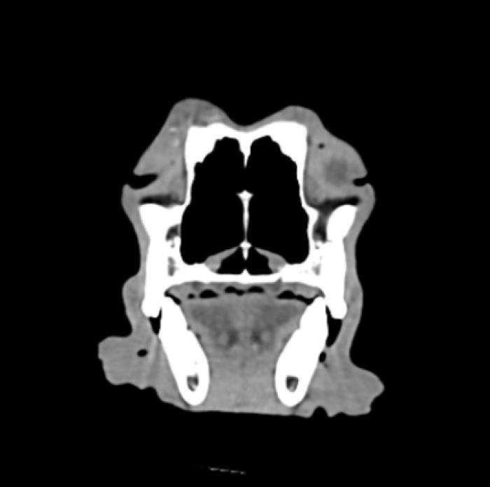 Figura 2. Tomografía axial computarizada, cortes de 2 mm de espesor, nótese en la región dorsal del hueso temporal derecho, una reacción perióstica interrumpida de tipo amorfa (imágenes cortesía de Mv. E. Marini; Lic L.Fedele, Córdoba).