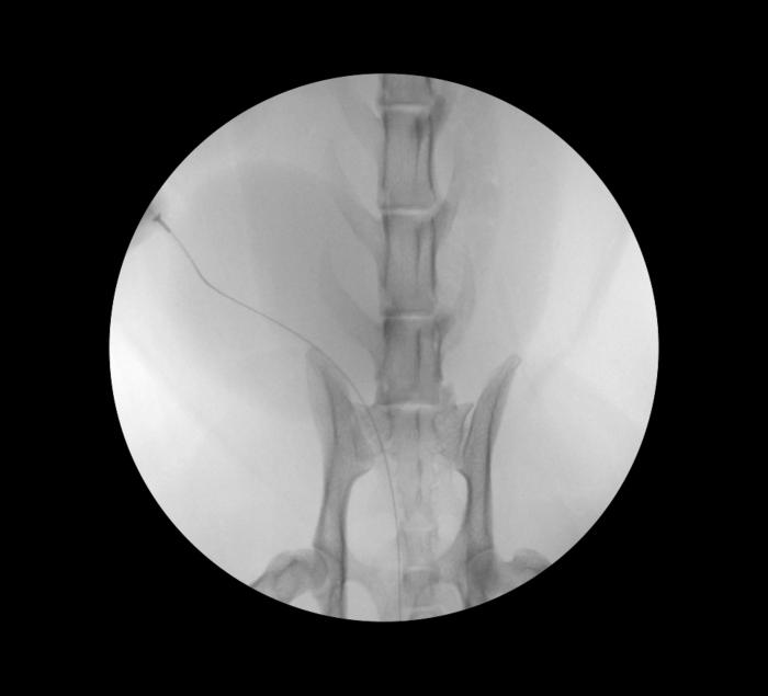 Figura 7. Control fluoroscópico del acceso uretral anterógrado vía percutánea en paciente felino. Proyección VD.