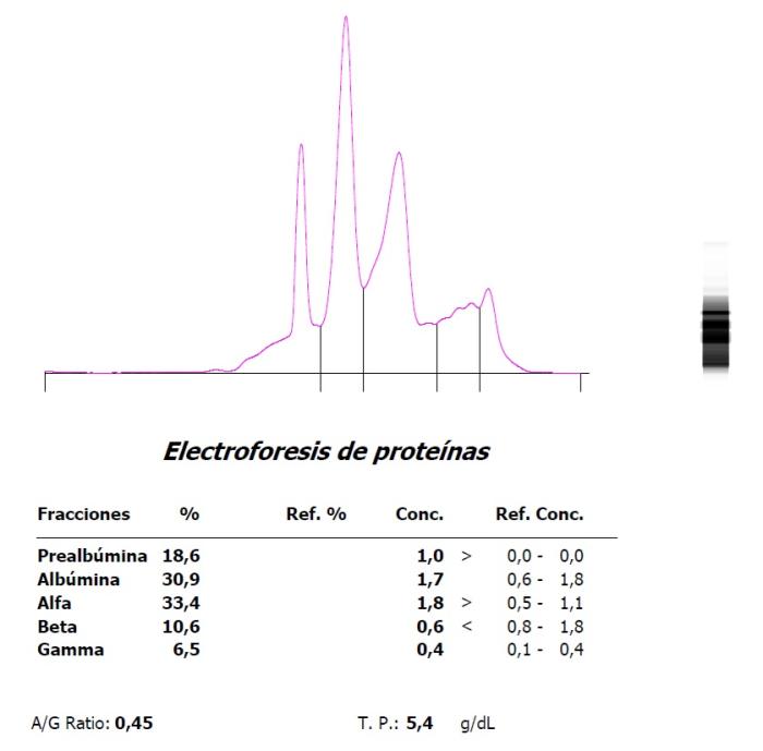 Figura 9. Aumento marcado de α globulinas en una Trachemys scripta hembra en fase reproductiva.