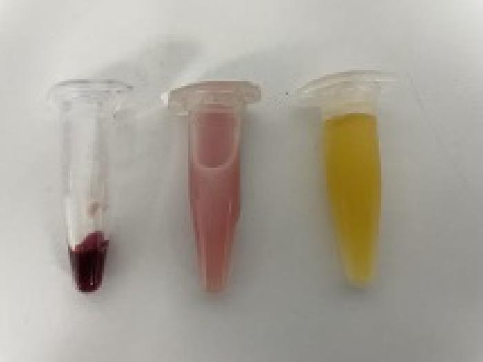 Figura 1. Ejemplo de la realidad de una clínica veterinaria en el día a día: muestras ictéricas, hemolizadas e incluso lipémica y hemolizada a la vez (imagen cedida por Salceda Vetpatogenius).