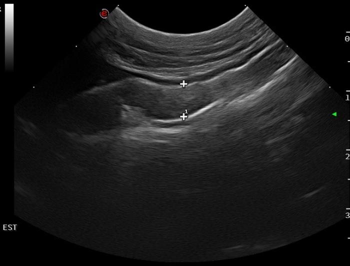 Figura 1.   Imagenes ecográficas del estómago en las que se observa (A) un área focal de engrosamiento acompañado de una pérdida de estratificación de las capas (imagen cedida por el Servicio de Diagnóstico por Imagen del Hospital Clínico Veterinario de la Universidad de Murcia),​​​​​​​ (B)  una banda hiperecogénica a nivel de la mucosa del estómago y una capa submucosa aumentada de grosor y ecogenicidad, y (C) leve engrosamiento del antro pilórico (imágenes cedidas por el Servicio de Diagnóstico por Imagen de JC1 Veterinarios).